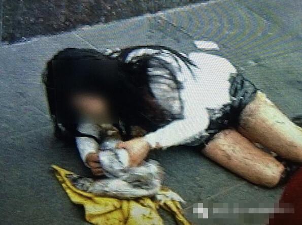 西安一女子当街被泼硫酸 年仅25岁重度烧伤命垂危