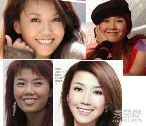网友疑王蓉患精神病 35岁王蓉整容隆胸照曝光