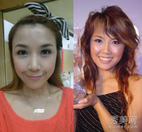 网友疑王蓉患精神病 35岁王蓉整容隆胸照曝光