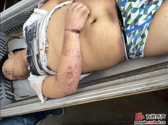 男子公安局内身亡 湖南警方回应:系