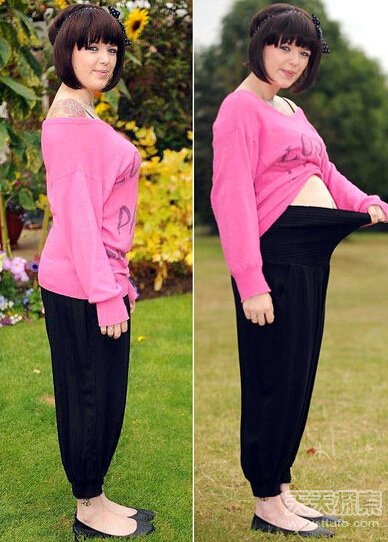 英女子患怪病 一进食肚皮就如气球似怀孕
