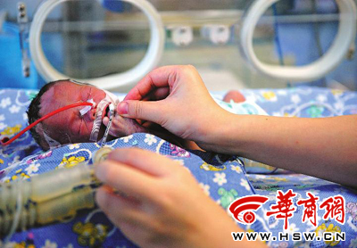早产女婴出生后不吃不喝 护士发微信