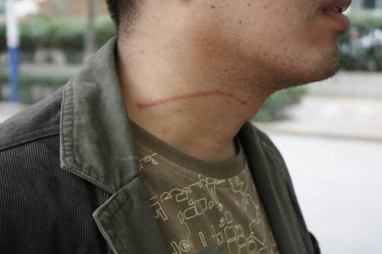 宝鸡一公司设铁丝路障 2名路人“中招”