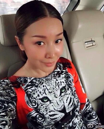 孙悦整容照曝光 早年罕见青涩照大起底