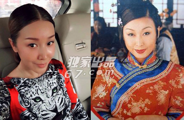 歌手孙悦疑整容牙冠咬死不承认 这样的明星还有谁？