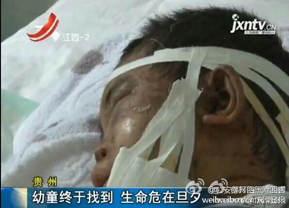 7岁幼童遭后母虐杀 煤洞中苦撑3天奇迹生还(图)