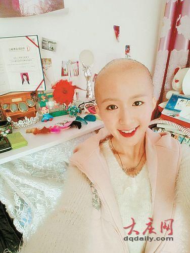 25岁女孩先天光头 借舞蹈抚平心中伤痕笑容灿烂