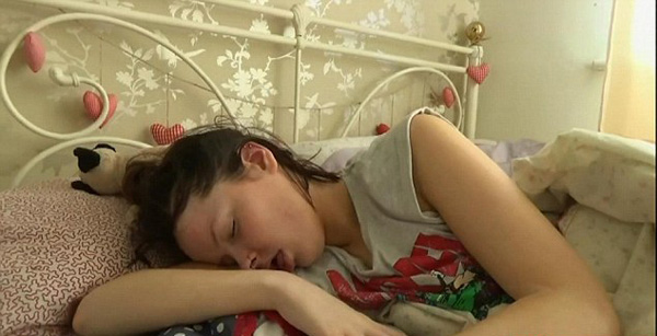 英国女子患睡美人症症 每天只有2小时醒着