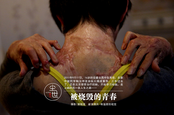 被烧毁的青春 16岁少女走上凤凰涅槃人生之路