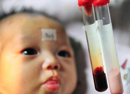 婴儿血液乳白色全国仅六例 难不成是遗传惹的祸？