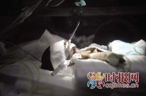 出生时仅1.32斤筷子宝宝的生命奇迹