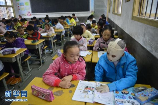 图为周涛戴着厚厚的弹力套上课学习。