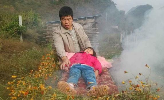 父为女治病采用火熏疗法 治疗β重型地中海贫血