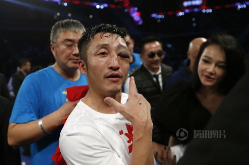 邹市明浴血完胜泰国拳王 眉骨被撞鲜血直流【组图】