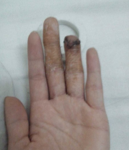 甘肃两名警察调戏女子遭拒 将其手指打断(图)
