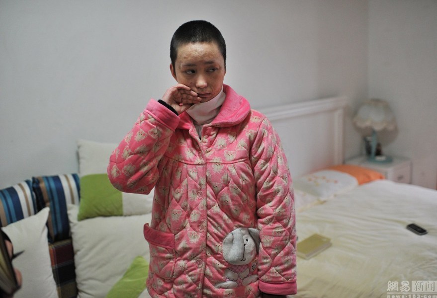 官二代毁容少女案开庭 美少女曾转学仍难逃噩运(图)