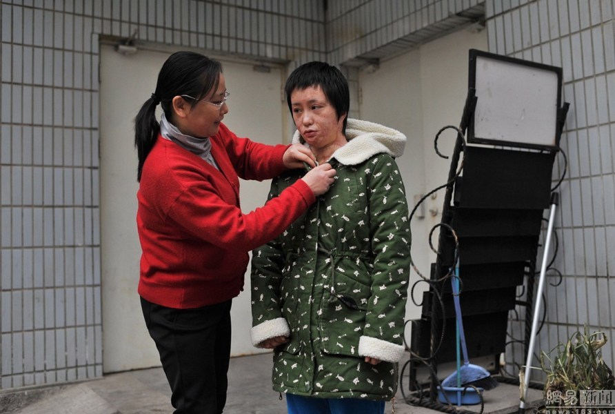 官二代毁容少女案开庭 美少女曾转学仍难逃噩运(图)