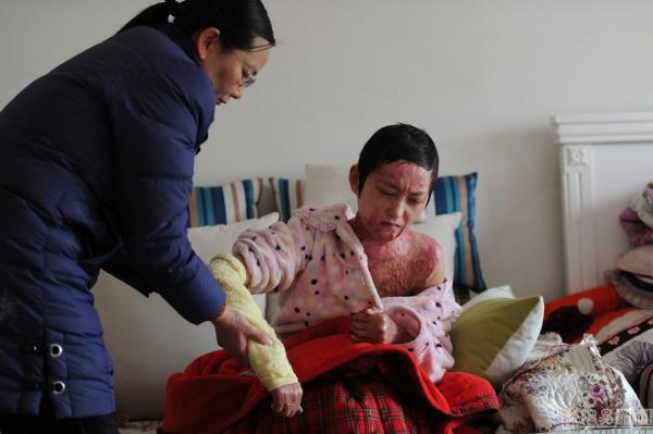 官二代毁容少女案再审 毁容少女讲述三年心路历程(图)