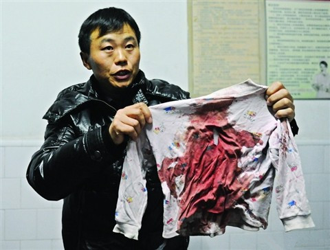 多名儿童当街被砍 行凶者持水果刀行凶遭群众制服