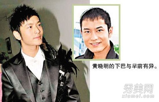 黄晓明baby洛杉矶合体 黄晓明baby甜蜜合照两人整容前丑照曝光